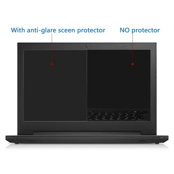 5pcs/lot Laptop Notebook Anti-Orbire Mat / Hig Clear LCD Screen Guard Film de 15.6 inch Laptop 16:9 Universal Ecran Protector